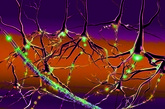 MS Nerve Cells V13C03
