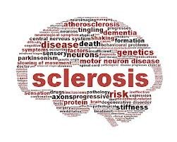 Multiple Sclerosis V14A24