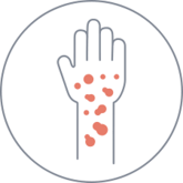 Plaque Psoriasis Stada v24K25
